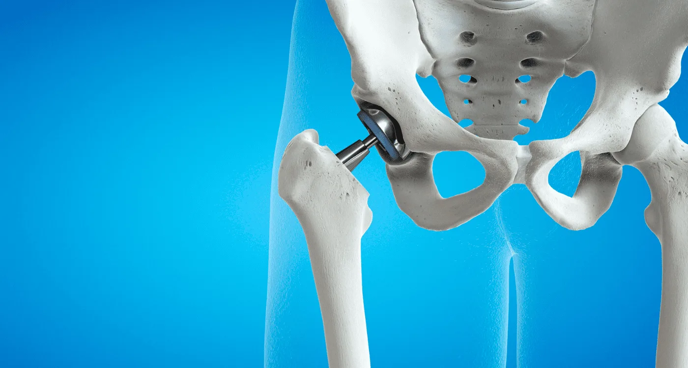 Cirugía de Columna Cervical de Alta Especialidad en la CDMX